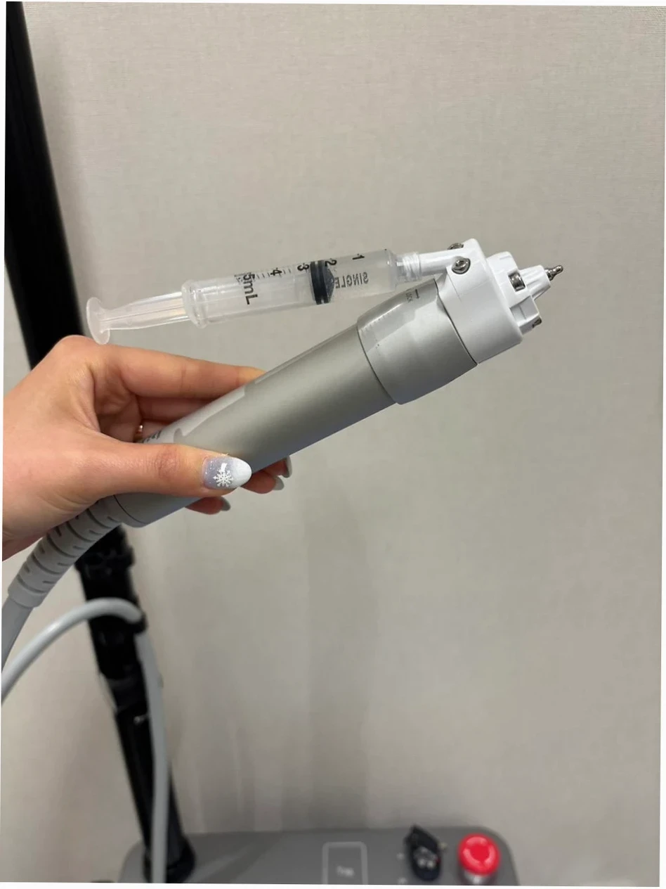한 손이 큐어젯 시술에 사용되는 기기를 잡고 있습니다. 기기 상단에는 주사기가 연결되어 있으며, 큐어젯 여드름 흉터 개선을 위한 시술 준비 과정을 보여줍니다.